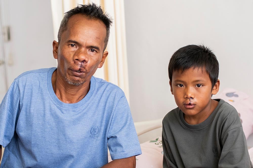Father and son Alim and Rajib - Smile Train's 2,000,000 and 2,000,001 cleft surgeries.