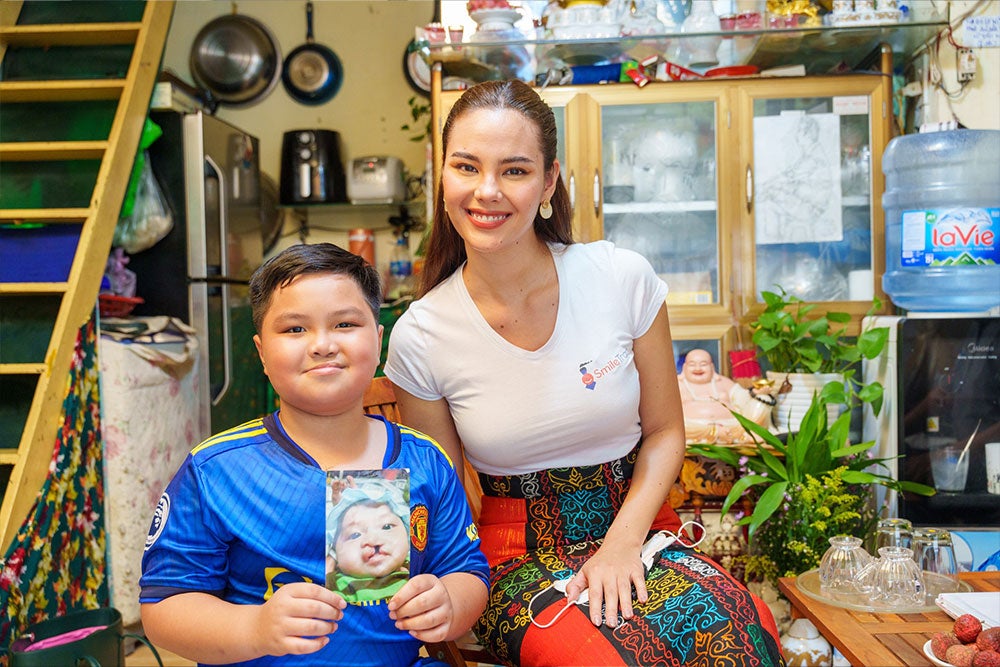 Catriona Gray with a Smile Train patient holding a picture of himself before cleft surgery