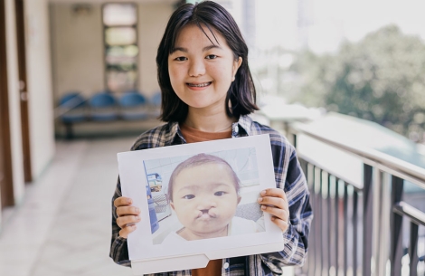 Jian smiling and holding a picture of herself before cleft surgery
