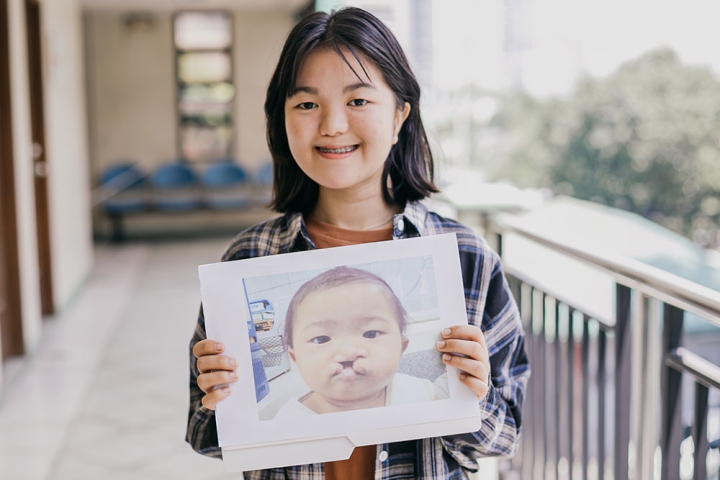 Jian smiling and holding a picture of herself before cleft surgery