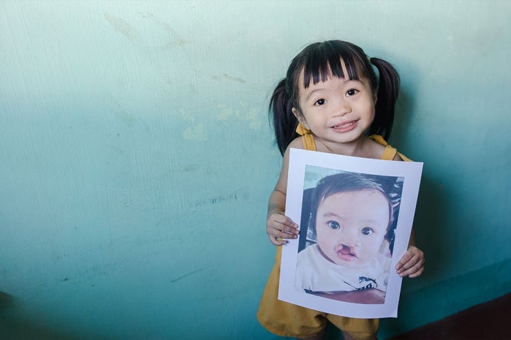 Zabriena smiling and holding a picture of herself before cleft surgery
