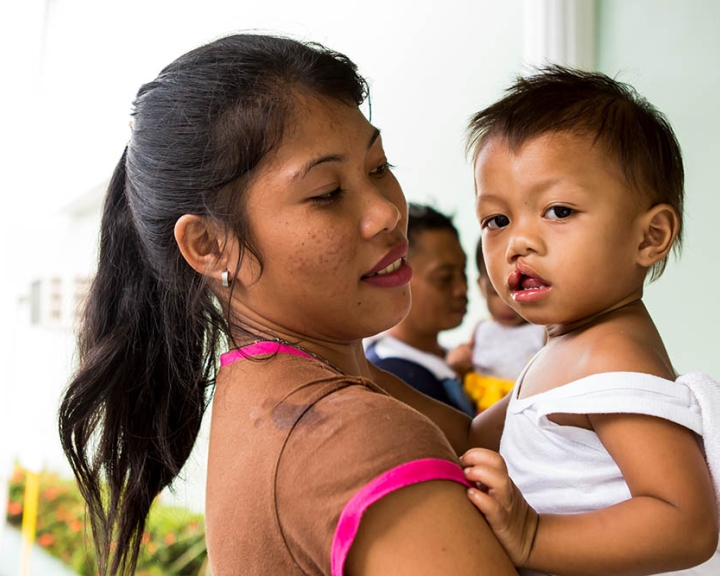 cleft patient with mother