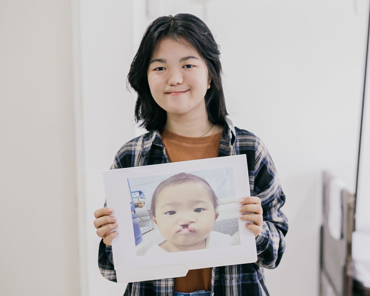 Woman holds up image before cleft surgery