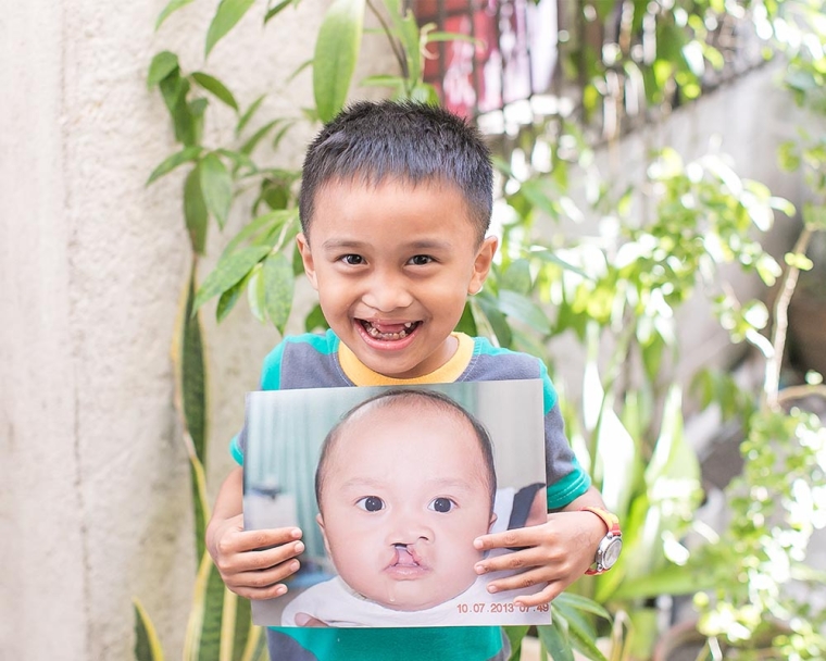 boy holds before image